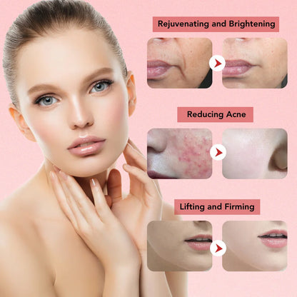 Skin Rejuvenator Massager